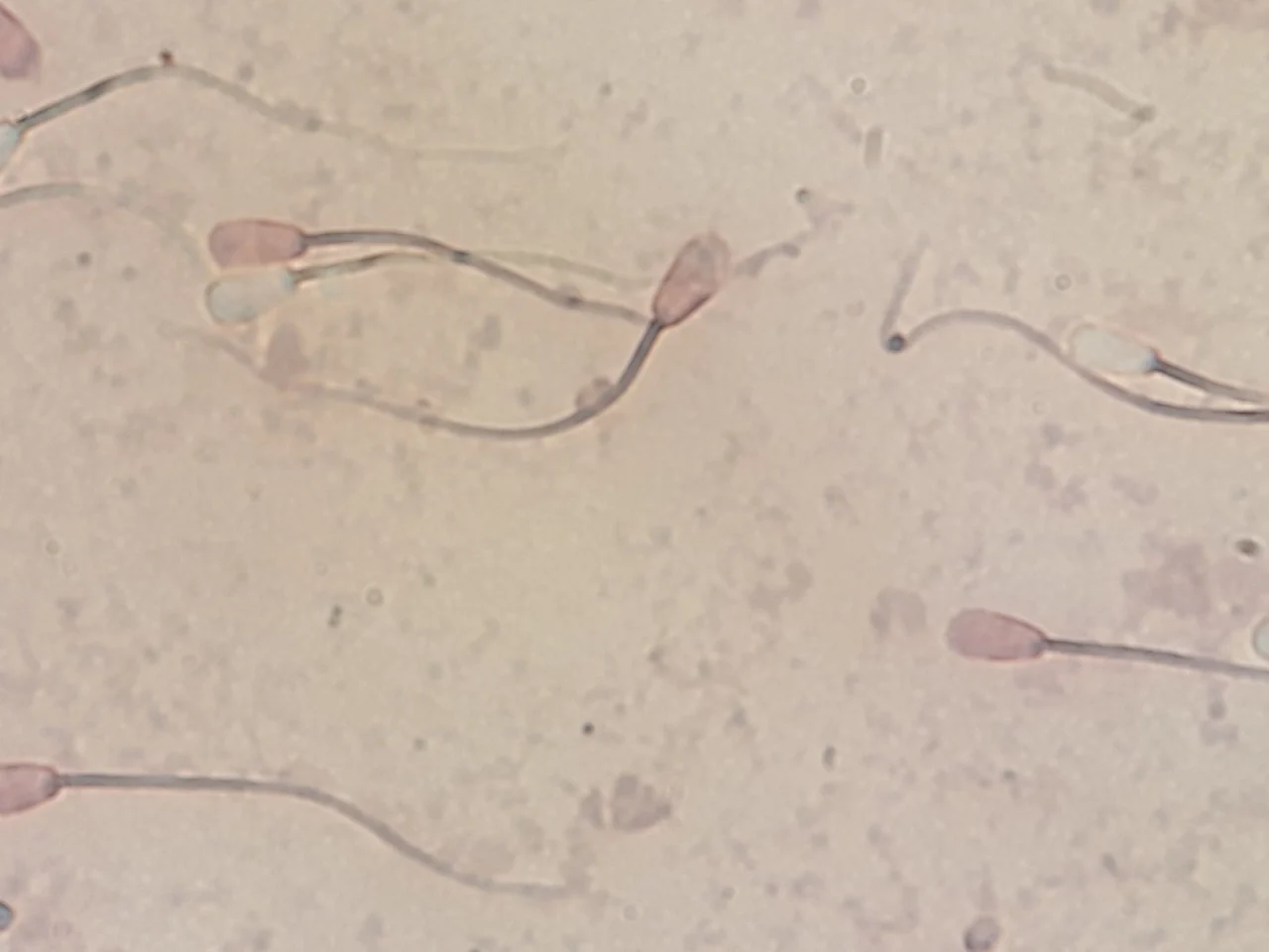 伊红-苯胺黑染色效果示意图:死精子头部染成粉红色,活精子不着色